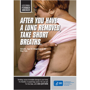 MOQC’s Assortment of American Cancer Society (ACS) Patient Story Posters*